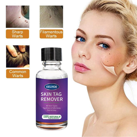 Cross-Border Eelhoe Skin Verrucous Remover