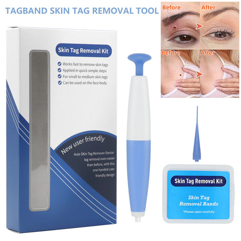 Skin Tag Removal Kit (Home Use)