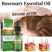 Rosemary Hair Growth Essential Oil