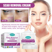 Fade Scars & Moisturize Cream