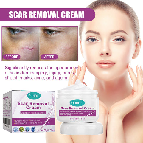 Fade Scars & Moisturize Cream