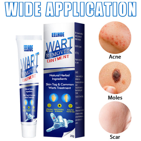 Zhongcao Keyou Wart Removal Cream