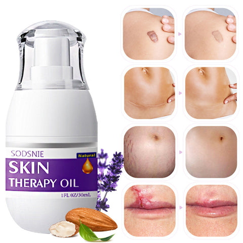 Skin Treatment Oil for Cellulite & Stretch Mark Repair (30ml)